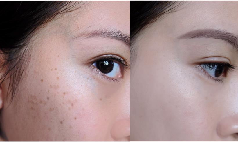 Phloretin whitening and lightening